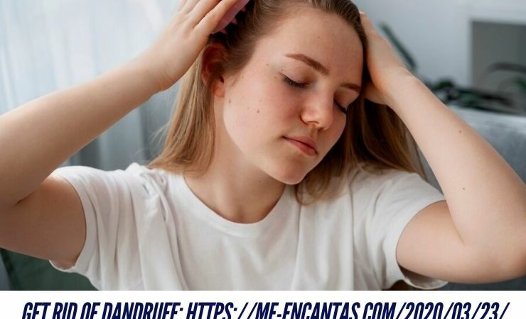 How to Correctly Get Rid of Dandruff: https://me-encantas.com/2020/03/23/como-eliminar-la-caspa-correctamente